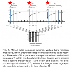 図4　MOLLI sequenceの撮影　　 文献[3]　より改変引用